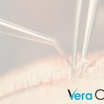 Can Veraclinic Help You Achieve Natural-Looking Hair Transplants in Turkey?